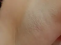 Шугаринг в Центре, фотография 2