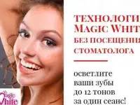 Косметическое отбеливание зубов MAGIC WHITE, фотография 3