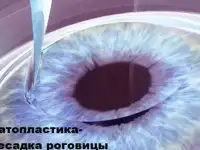 Компания Медицинский союз, фотография 10