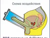 УЗИ, ЭКГ, ЛОД-терапия, анализы, капельницы, инъекции, консультации врачей в центре СПб, фотография 11