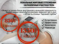 Криолиполиз, коррекция фигуры