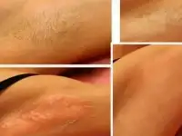Шугаринг мужской и женский