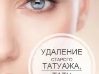 Удаление тату и татуажа, фотография 6