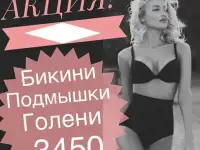 Лазерная Эпиляция, фотография 6