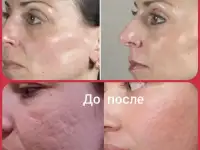 КОСМЕТОЛОГИЧЕСКИЕ УСЛУГИ, фотография 4
