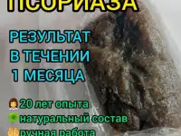 Мазь от псориаза. Опыт более 20 лет.