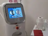 Лазерная эпиляция