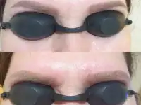 Лазерное удаление татуировок и татуажа в СВАО, фотография 12