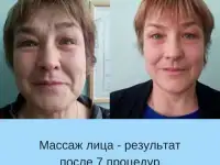 Массаж лица