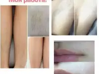Гелевая эпиляция Let's Gel, фотография 2