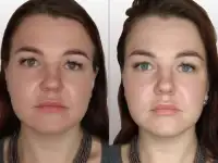 Массаж лица, фотография 3