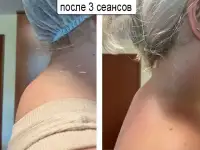 Массаж холки на шее, фотография 3