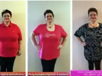 LipoDiet - курс похудения Неинвазивная липосакция - эффективность клинически доказана