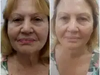 Сет Gemma, корейская косметика, Gemmove Queen, фотография 11