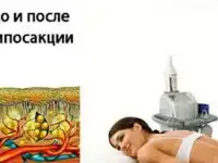 косметология, фотография 2