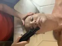Омоложение лица без операций, фотография 6