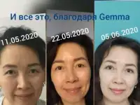 Сет Gemma, корейская косметика, Gemmove Queen, фотография 4