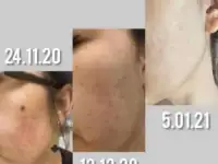 Сет Gemma, корейская косметика, Gemmove Queen, фотография 6