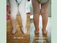 Детский массаж, гимнастика, электрофорез, фотография 5