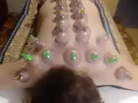 Массаж и восстановление, фотография 4
