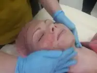 пиллинг жёлтый, фотография 2