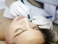 Электроэпиляция в Нижнем Новгороде., фотография 2