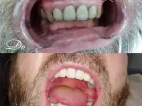 Лечение и протезирование зубов в Китае, фотография 2