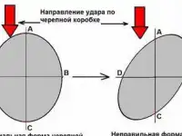 Правка головы после травм