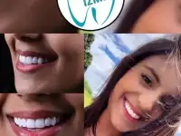 Go To Smile (СТОМАТОЛОГИЧЕСКИЙ ТУРИЗМ) (эстетическая стоматогия в Турции), фотография 9