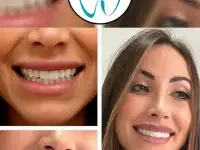 Go To Smile (СТОМАТОЛОГИЧЕСКИЙ ТУРИЗМ) (эстетическая стоматогия в Турции), фотография 6