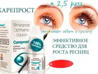 Карепрост в Ярославле