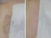 Мастер шугаринга, фотография 4