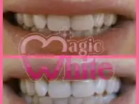 Студия отбеливания зубов MagicWhite, фотография 4