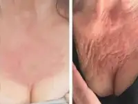 Эффективное омоложение, фотография 2