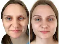 Уникальная методика восстановления бровей