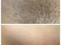 Студия восковой эпиляции и шугаринга SunBeautyKzn, фотография 2