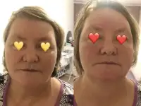 Массаж лица и коррекция бровей