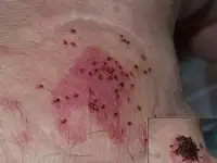 Уничтожение клопов и др.насекомых (холодным туманом).