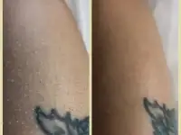 Шугаринг и восковая депиляция, фотография 6
