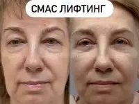 Услуги косметолога