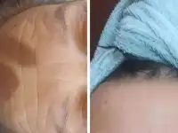 Услуги косметолога массаж в Сочи.