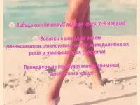 Шугаринг, фотография 6