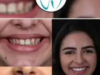 Go To Smile (СТОМАТОЛОГИЧЕСКИЙ ТУРИЗМ) (эстетическая стоматогия в Турции), фотография 3