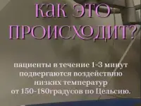 Криотерапия