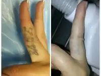Лазерное удаление татуировок и татуажа в СВАО, фотография 7