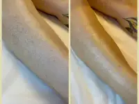 Шугаринг и восковая депиляция, фотография 4