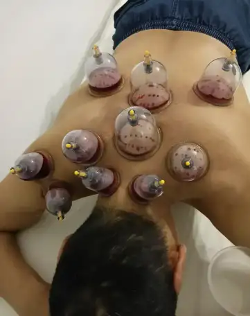 Хиджама, фотография 4