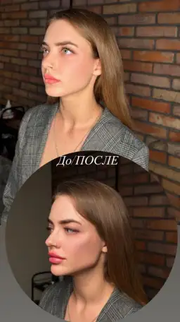 Косметолог Воронеж, фотография 6