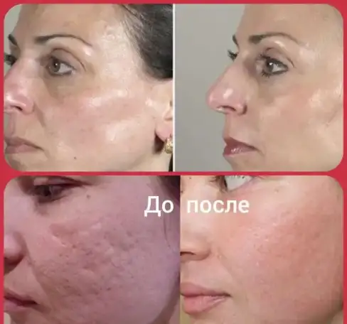 КОСМЕТОЛОГИЧЕСКИЕ УСЛУГИ, фотография 4