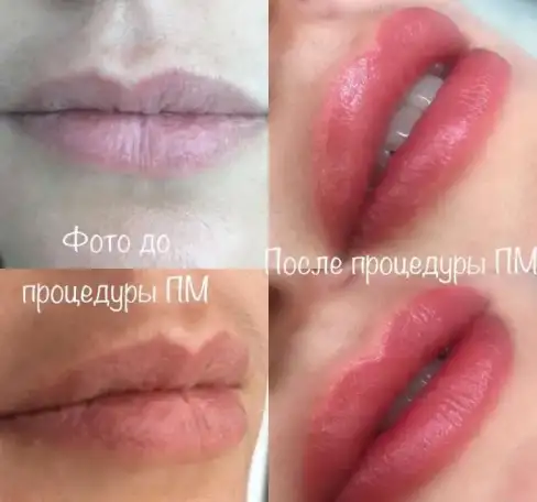 Перманентный макияж, удаление, окрашивание, фотография 1